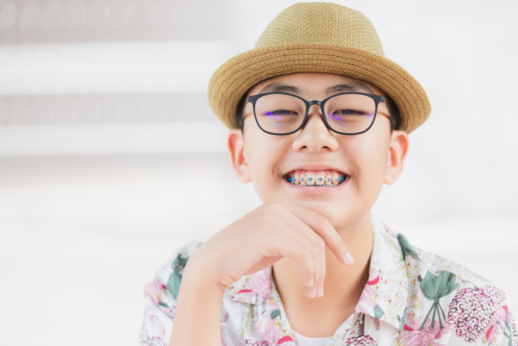 How Do You Floss With Braces? Tender Smiles 4 Kids