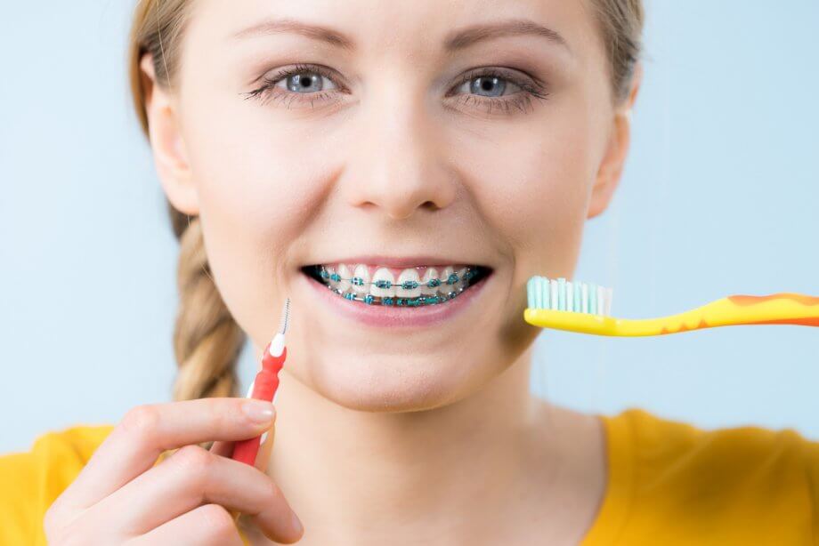 What Do Rubber Bands Do For Braces?, Tender Smiles 4 Kids