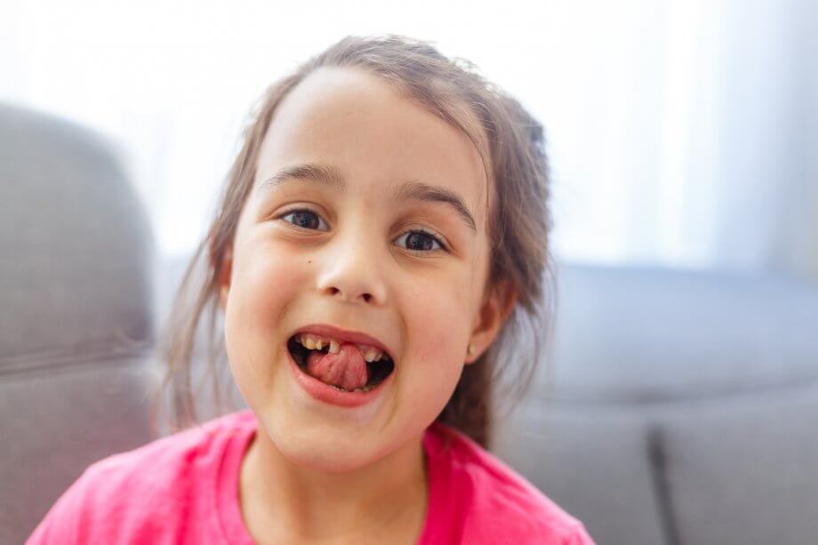 young girl with missing teeth