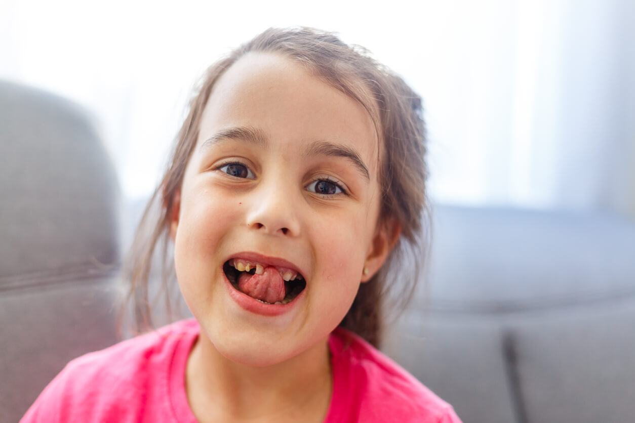 Losing Baby Teeth: What to Expect | Tender Smiles 4 Kids