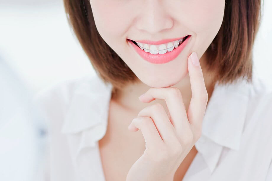 Retainers After Braces: What You Should Know