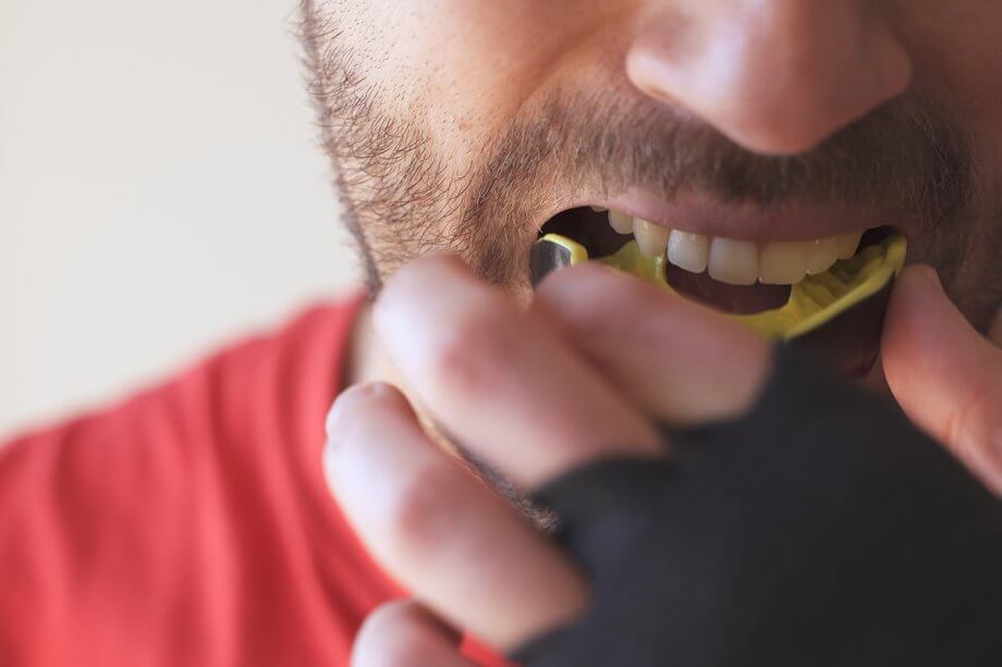 Sports Mouthguards: What You Need to Know
