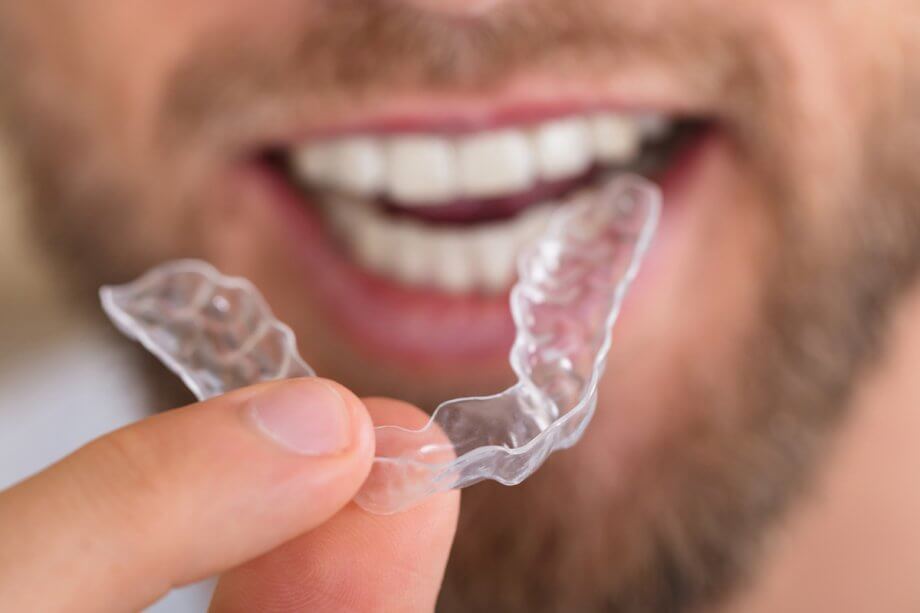 a man holds an Invisalign aligner