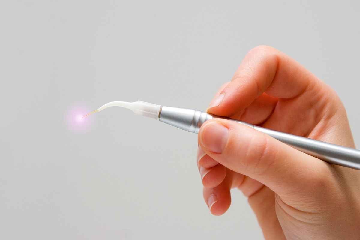 What Is Pediatric Laser Dentistry? NJ Tender Smiles